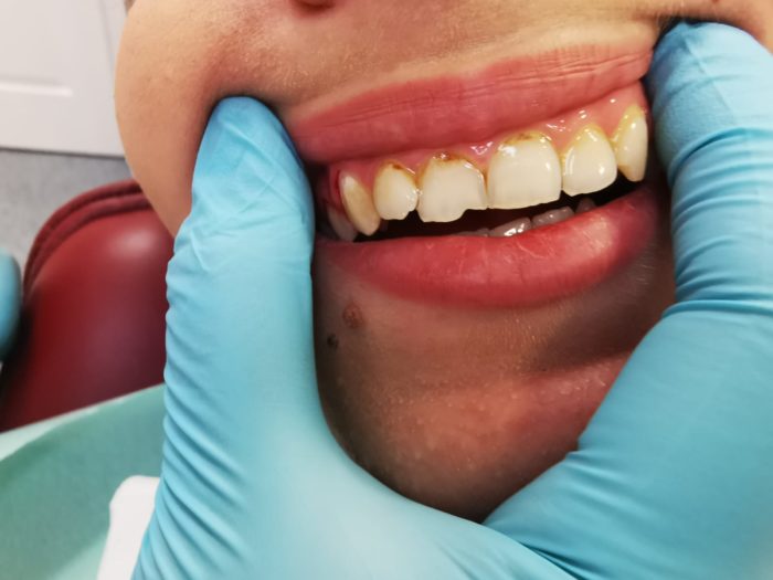 Estetică dentară prin Clinica Dr. Saki Estetix