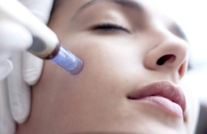 Terapia vampir face minuni pentru piele