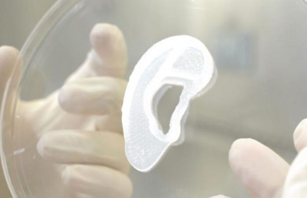 Implant de ureche imprimată 3D pe bază de celule umane, realizat în Statele Unite