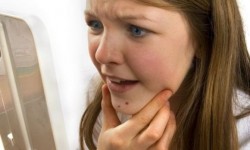 3 sfaturi naturiste ca să tratezi acneea