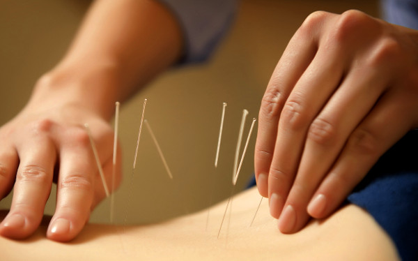 Cine a inventat acupunctura?