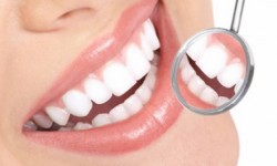 Cum sa cureti piatra de pe dinti chiar la tine acasa!