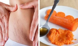 Tratament pentru vergeturi pe bază de morcov