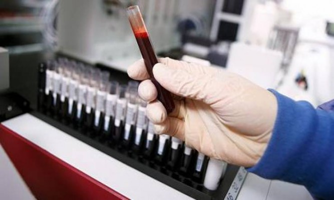 Remediul pentru HIV, mai aproape de realitate după ce un pacient a scăpat complet de acest virus