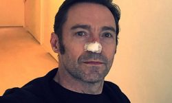Actorul australian Hugh Jackman a fost tratat din nou pentru cancer de piele