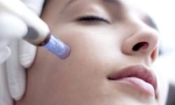 Terapia vampir face minuni pentru piele