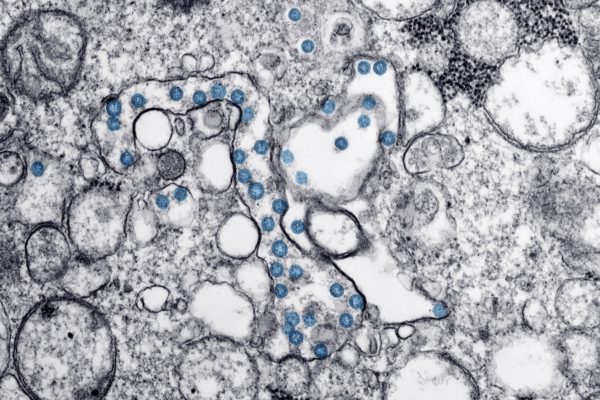 Cercetători spanioli au creat un nanomaterial care elimină virusul şi ar putea fi utilizat la măştile sanitare