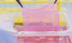 VIDEO Elveţia a dezvoltat primul aparat care produce piele pentru transplanturi