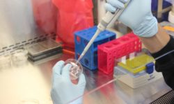 Cercetătorii israelieni au dezvoltat un medicament bazat pe ARN care distruge celulele canceroase din măduva osoasă